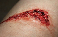 Thigh Laceration Prosthetic