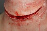 Simple Slit Throat Prosthetic