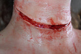 Simple Slit Throat Prosthetic