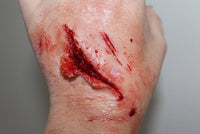 Small Shallow Laceration Prosthetic