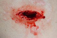 Stab Wound Prosthetic