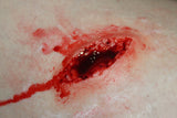 Stab Wound Prosthetic