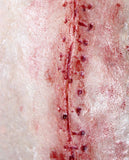 Opened Stitches Prosthetic