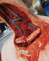 Open Collarbone Wound Prosthetic
